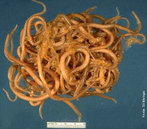 <em>Ascaris lumbricoides</em>  um verme asquelminto parasita causador da ascaridase. Este verme nematdio  um parasita muito conhecido como lombriga intestinal. Este microorganismo infecta os seres humanos e mais freqentemente as crianas. Aloja-se normalmente no intestino delgado e s vezes dirige-se para outras partes do corpo. Seu comprimento pode variar de 15 a 25 cm. </br></br> Palavra-chaves: <em>Ascaris lumbricoides</em>, ascaridase, verme, parasita, sade, higiene.