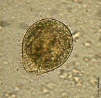 <em>Balantidium coli</em>  um protista ciliado causador da balantidiose, uma infeco do intestino grosso que provocam diarreia com sangue nas fezes, de modo semelhante ao que ocorre na disenteria amebiana. </br></br> Palavra-chaves: <em>Balantidium coli</em>, balantidiose, protista ciliado, diarreia.