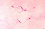 O <em>Trypanosoma cruzi </em> um importante protozorio flagelado, agente etiolgico da doena de Chagas, tripanossomase americana ou esquizotripanose. A doena foi descoberta em 1909 pelo mdico brasileiro Carlos Chagas. </br></br> Palavras-chave: protista, protozorio, <em>Trypanosoma cruzi </em>, flagelado, agente etiolgico. 