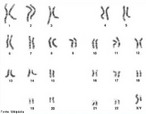 Caritipo  o conjunto cromossmico ou a constante cromossmica diplide (2n) de uma espcie. Representa o nmero total de cromossomos de uma clula somtica (do corpo). Imagem de um caritipo humano masculino. <br /><br /> Palavras-chave: caritipo, conjunto cromossmico, cromossomo, gentica.