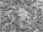 <em>Vibrio cholerae</em>: A bactria que causa clera (ao microscpio eletrnico) <br /><br /> Palavras-chave: clera, vibrio colrico, bactria, microscpio eletrnico.