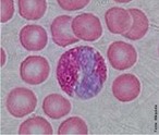 Granulcitos eosinfilos, geralmente chamados de eosinfilos (ou, menos comumente, acidfilos), so clulas do sistema imune responsveis pela ao contra parasitas multicelulares e certas infeces nos vertebrados. Junto com os mastcitos, tambm controlam mecanismos associados com a alergia e asma. Desenvolvem-se na medula ssea (hematopoiese) antes de migrar para o sangue perifrico. <br /><br /> Palavras-chave: eosinfilo, sangue, leuccitos, glbulos brancos. 