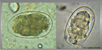 Os ovos dos helmintos causadores da ancilostomase possuem forma ovalada, casca fina e transparente e um espao largo e claro entre a casca e o contedo dos ovos. As larvas rebditide apresentam bulbo esofageano (esfago do tipo rabditide) e vestibulo bucal longo. J as larvas filariide apresentam esfago cilndrico (do tipo filariide) e cauda pontiaguda. <br /><br /> Palavras-chave: ancilostomose, nematelminto, amarelo.