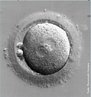 vulo fertilizado 24 horas aps o encontro com os espermatozides. </br></br> Palavras-chave: ovulao, vulo, ovrio, fertilizao. 
